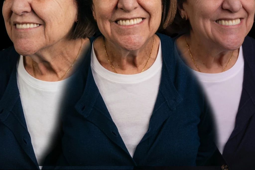 3 smaile face