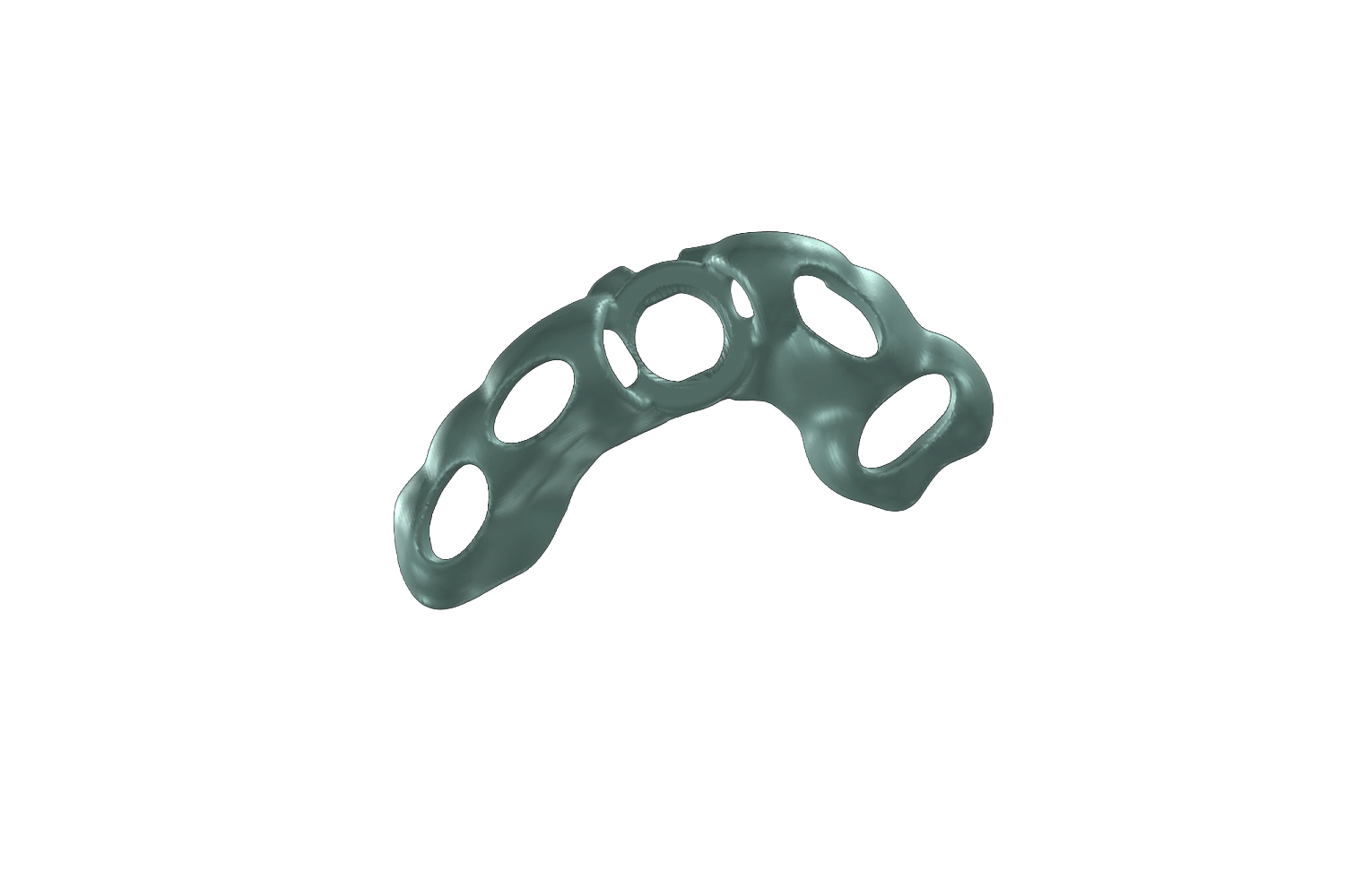 Guide chirurgical imprimé positionné sur un modèle